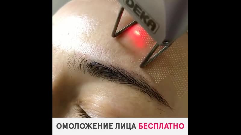 Аппаратное омоложение лица бесплатно!