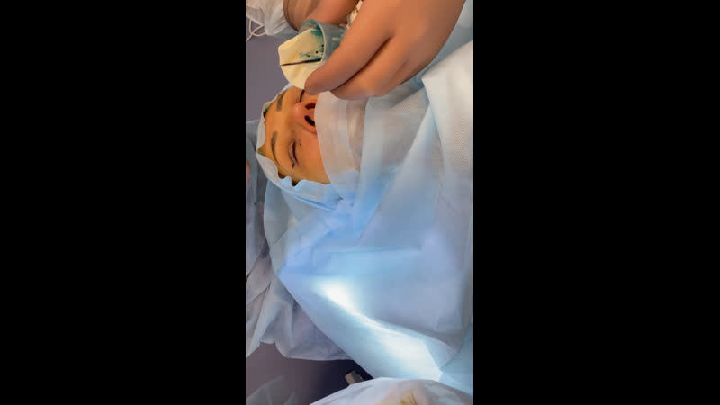 Разметка самый важный этап перед любой пластической операцией