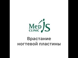 Видео от med is clinic подолог, вросший ноготь краснодар