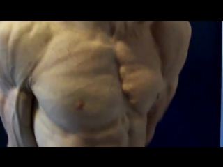 Vascular chest