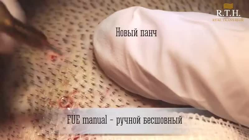 Какими инструментами выполняется пересадка волос в real trans hair