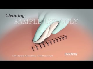 21 incision care discharge instructions