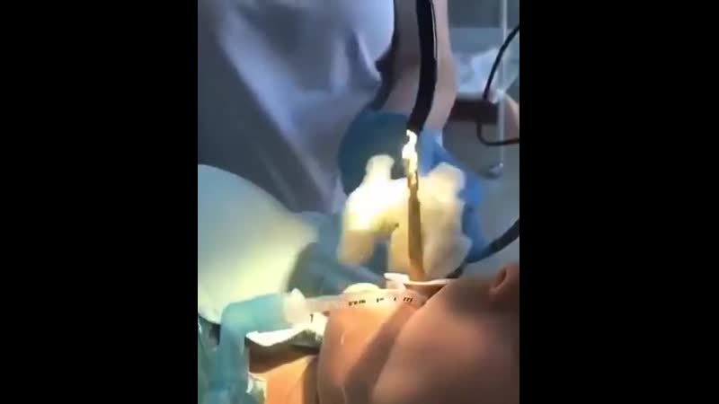 В дагестане спящей девушке в рот заползла змея