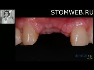 Advances in hard and soft tissue management using 3d printing