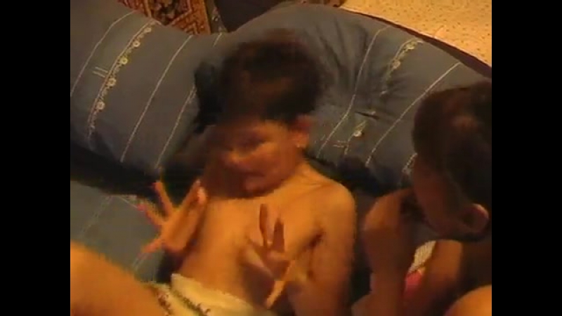 Ретроспектива на зш| страшный ожог