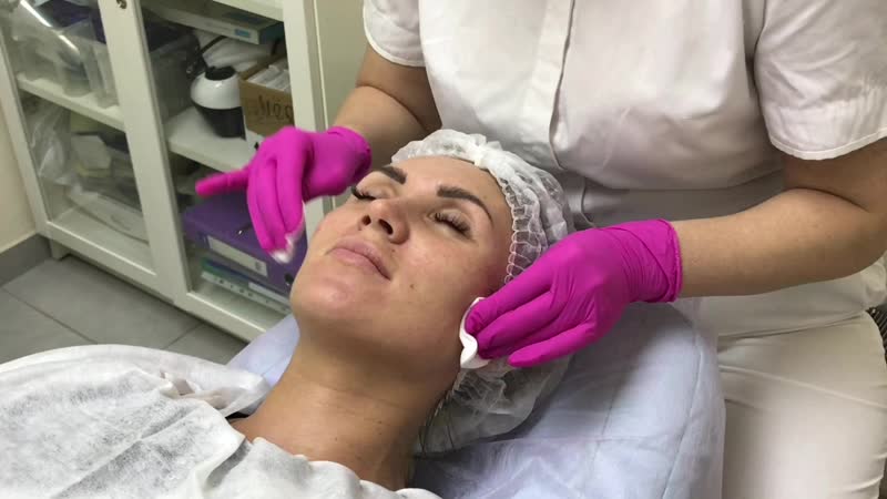 Мезотерапия лицо