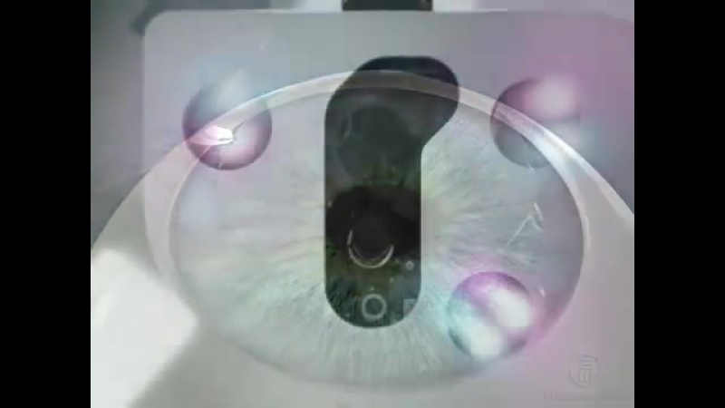 Памятка, готовящемуся к операции lasik