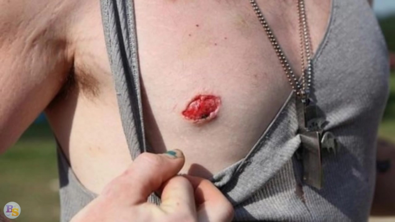 Что будет если отрезать сосок