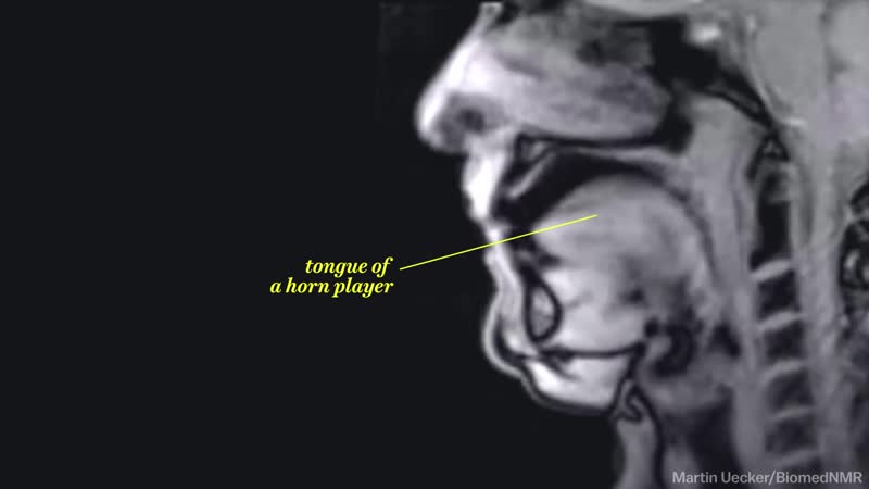 Секс через аппарат мрт ​​​​​​