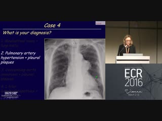 How to avoid misdiagnosis on the chest x ray non neoplastic lesions a r larici