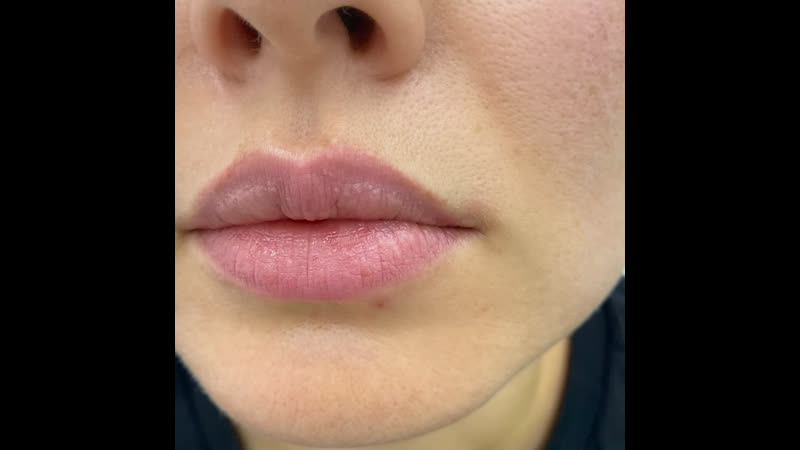 Заживший перманентный макияж губ