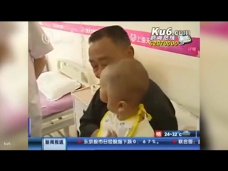 Chinas mask boy has birth defect where he appears to have