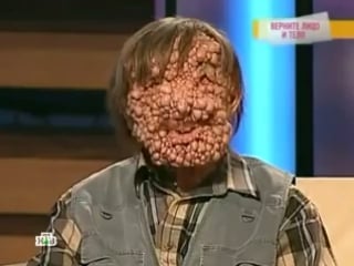 Типичная махачкала +18 опухоли