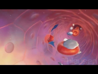 42 тромбоцитопения, вызванная химиотерапией