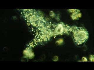 Amazing amoeba in high definition!