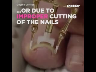 Инструмент для вросших ногтей