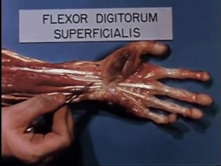 Ever wondered how the muscles and tendons that help you flex your fingers work?