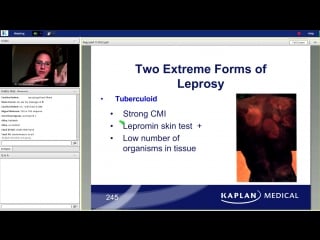 28th lecture kaplan step 1 ca microbiology moscatello feb 16, 2014