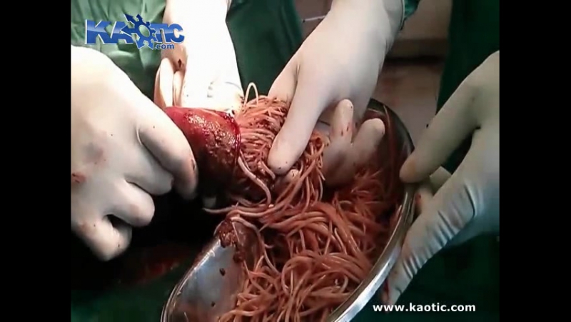 Когда поел шавухи на кругу